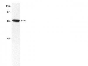 ATM/Chk2 Pathway Explorer Antibody MiniPack 15-116