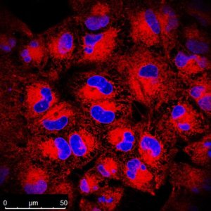 BioTracker TiY Vimentin Live Cell Dye SCT059
