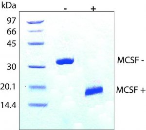 Macrophage Colony-Stimulating Factor human 