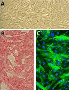 Human Aortic Smooth Muscle Cells: HAOSMC, adult 354-05A