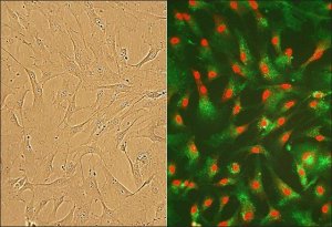 Human Cardiac Fibroblasts: HCF, adult 306-05A