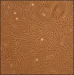 Human Chondrocytes - Osteoarthritis: HC-OA, adult 402OA-05A