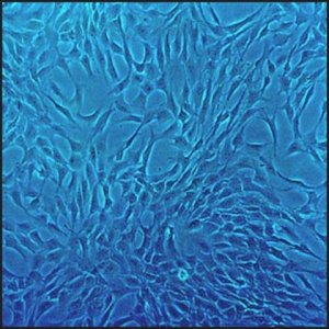 Human Chondrocytes: HC, adult 402-05A