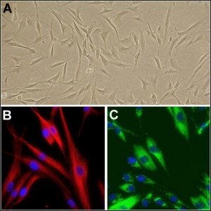 Human Dermal Fibroblasts: HDF, neonatal 106-05N