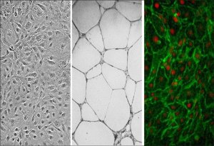 Human Dermal Microvascular Endothelial Cells: CADMEC/HMVEC, neonatal 100-05N