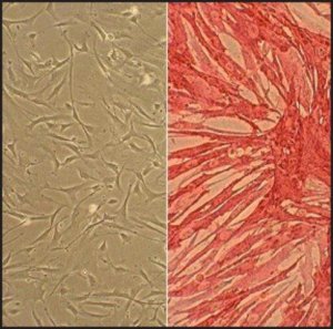Human Internal Thoracic Artery Smooth Muscle Cells: HITASMC, adult 358-05A