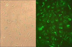 Human Lung Fibroblasts: HLF, adult 506-05A