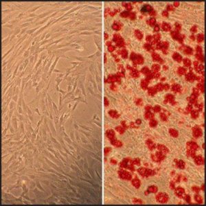 Human Marrow Stromal Cells: HMSC, adult 492-05A