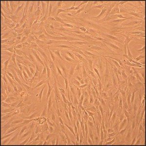 Human Osteoblasts-Osteoarthritis: HOb-OA, adult 406OA-05A