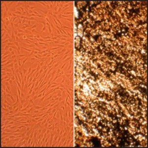 Human Osteoblasts: HOb, adult 406-05A