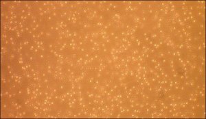 Human Peripheral Blood Monocytes: HPBM 6906-50A