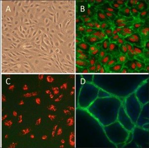 Human Umbilical Vein Endothelial Cells: HUVEC, neonatal, pooled 200P-05N