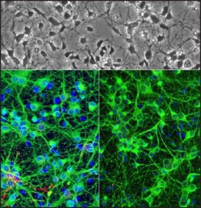 Rat Hippocampal Neurons: RHiN R886N-10