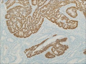 p53 (EP9) Rabbit Monoclonal Primary Antibody 