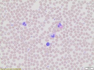 Wright-Giemsa Stain, Modified WG32-1L