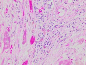Hematoxylin Solution, Gill No. 2 GHS2128-4L
