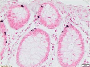 Argentaffin TISSUE-TROL� Control Slides TTR013-25EA