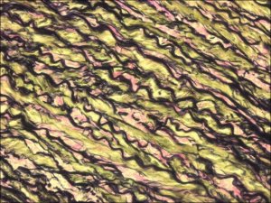 Elastic TISSUE-TROL� Control Slides 