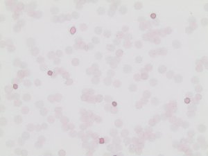 Fetal Hemoglobin Kit 285C-1KT