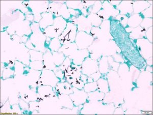 Fungi TISSUE-TROL� Control Slides 