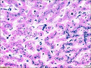 Iron TISSUE-TROL� Control Slides 