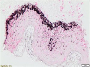 Melanin TISSUE-TROL� Control Slides TTR014-25EA