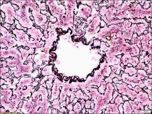 Reticulum TISSUE-TROL� Control Slides 