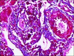 Trichrome Stain (Masson) Kit HT15-1KT