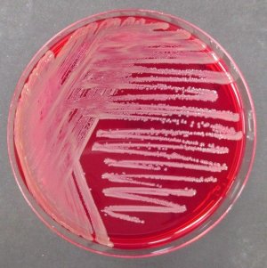 Burkholderia cepacia Selective Agar 
