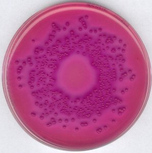 GranuCult� VRBD (Violet Red Bile Dextrose) agar 