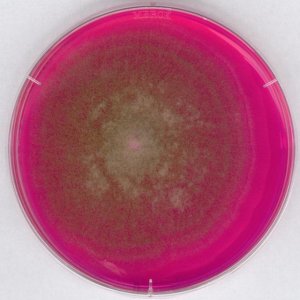 Rose-Bengal Chloramphenicol Agar (RBC) 