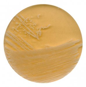 Tryptic soy agar with polysorbate 80 and lecithin 