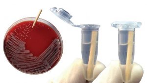smartPick� Wooden inoculation picks 