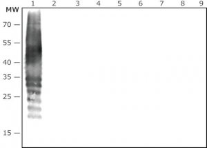 Anti-Porphyromonas gingivalis antibody produced in rabbit 