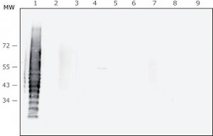 Anti-Porphyromonas gingivalis LPS antibody, Mouse monoclonal 