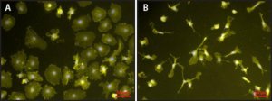 Lipopolysaccharides from Escherichia coli O111:B4 