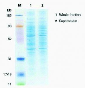 cOmplete� Lysis-M 4719956001