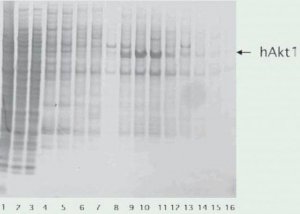 cOmplete�, EDTA-free Protease Inhibitor Cocktail 