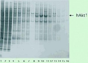 cOmplete�, Mini, EDTA-free Protease Inhibitor Cocktail 4693159001