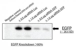 X-tremeGENE� siRNA Transfection Reagent 