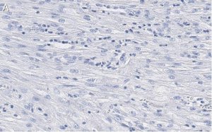 Anti--Actin Antibody, clone 6L12, ZooMAb� Rabbit Monoclonal 