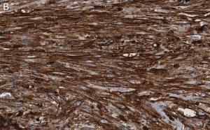 Anti--Actin Antibody, clone 6L12, ZooMAb� Rabbit Monoclonal 