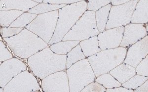 Anti--Dystroglycan Antibody, clone VIA4-1 ZooMAb� Mouse Monoclonal 