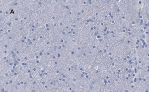 Anti--Tubulin III Antibody, clone 5H16, ZooMAb� Rabbit Monoclonal 