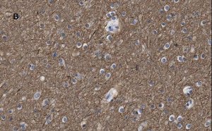 Anti--Tubulin III Antibody, clone 5H16, ZooMAb� Rabbit Monoclonal 