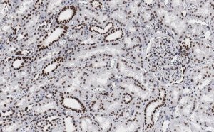 Anti-53BP1 Antibody, clone 1H16 ZooMAb� Rabbit Monoclonal 