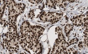 Anti-53BP1 Antibody, clone BP13 ZooMAb� Mouse Monoclonal 