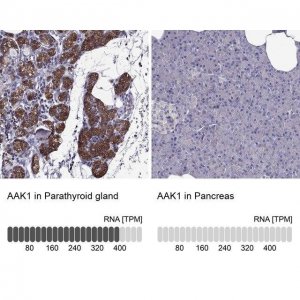 Anti-AAK1 antibody produced in rabbit 