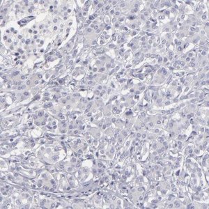Anti-ABCC4 antibody produced in rabbit 