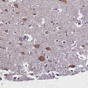 Anti-ABCC8 antibody produced in rabbit 